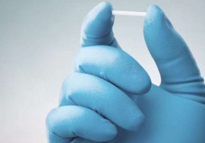 O novo implante contraceptivo Implanon, oferecido de forma gratuita pelo SUS, funciona durante 3 anos.- Foto: divulgação