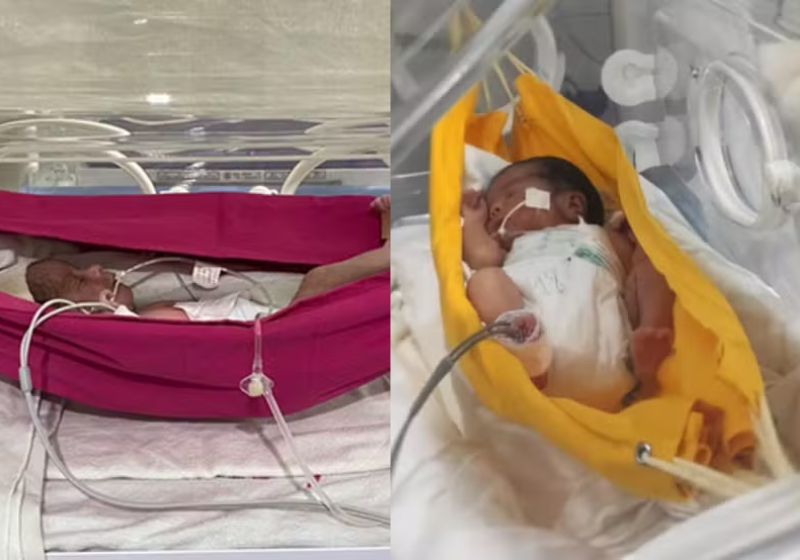 A pesquisa mostrou que dormir de rede ajuda bebês prematuros a se desenvolverem melhor porque lembra o ambiente do útero materno. - Foto: UFC