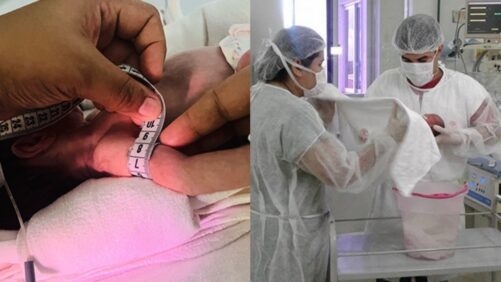 Estudo analisou um grupo de 60 crianças e foi conduzido por especialistas da UFC. — Foto: UFC/Reprodução