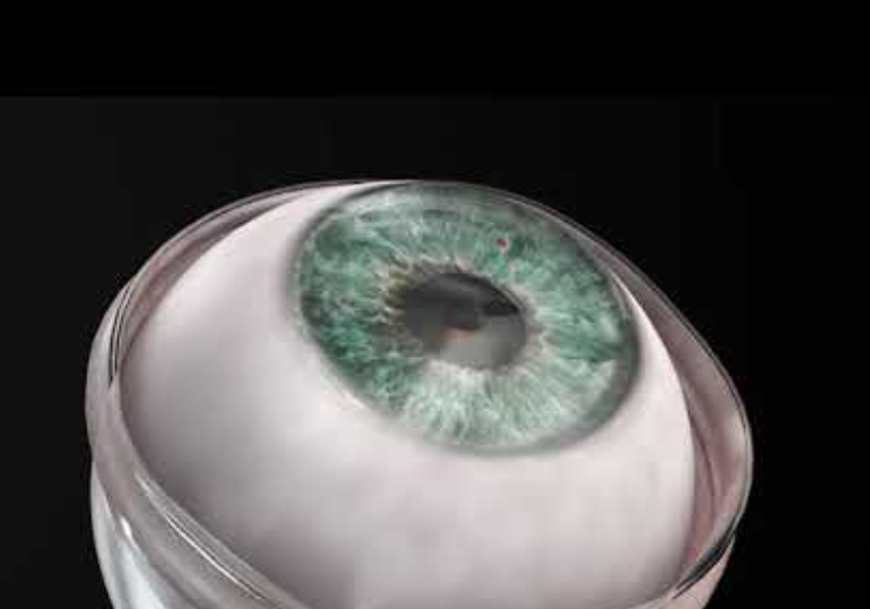 Após 10 anos, o paciente conseguiu voltar a enxergar graças a um transplante de córnea sintética inovador - Foto: reprodução