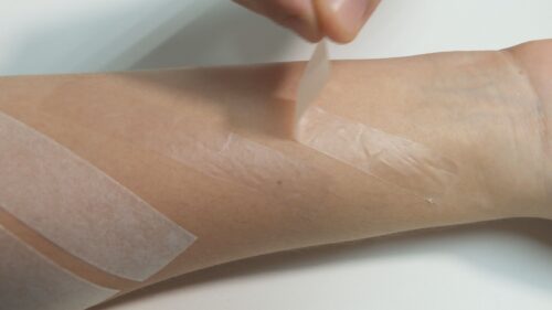 O curativo é considerado mais eficaz e causa menos dor. - Foto: UFPE