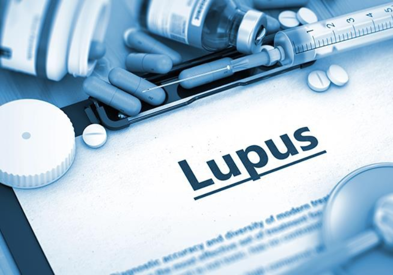 Pacientes com Lupus agora podem ter acesso a tratamento também pelo plano de saúde - Foto: Gov.br