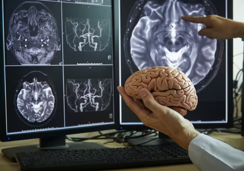 Neurônios sobrevivem, como evidenciado por novas descobertas científicas Neurônios permanecem vivos e pesquisa recente evidencia isso. Avanços promissores para Alzheimer e Parkinson