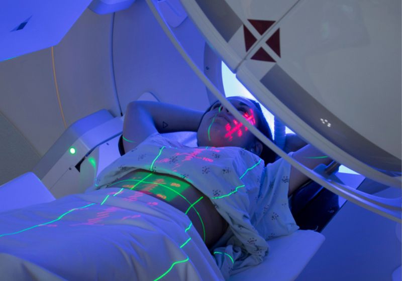 Pacientes que tratam câncer pelo SUS vão receber bolsa de R$ 300 para transporte, estadia e alimentação em sessões de radioterapia. - Foto: drmarcelocruz