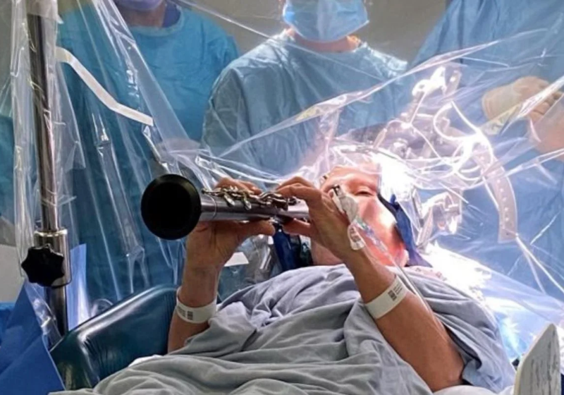 Denise, a mulher que tocou clarinete durante cirurgia contra o Parkinson, em Londres, não conseguia tocar há anos. - Foto: ing’s College Hospital