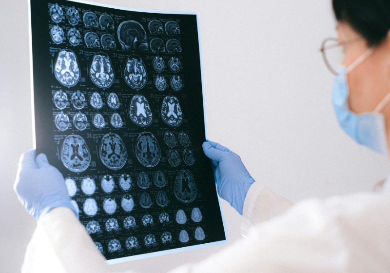 Encontrar um propósito de vida pode ser essencial para evitar a demência, segundo uma nova pesquisa - Foto: Canva