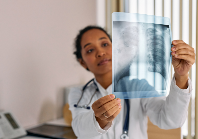 Uma nova pesquisa descobriu como frear a osteoporose através de um receptor que já existe em nosso organismo - Foto: Canva