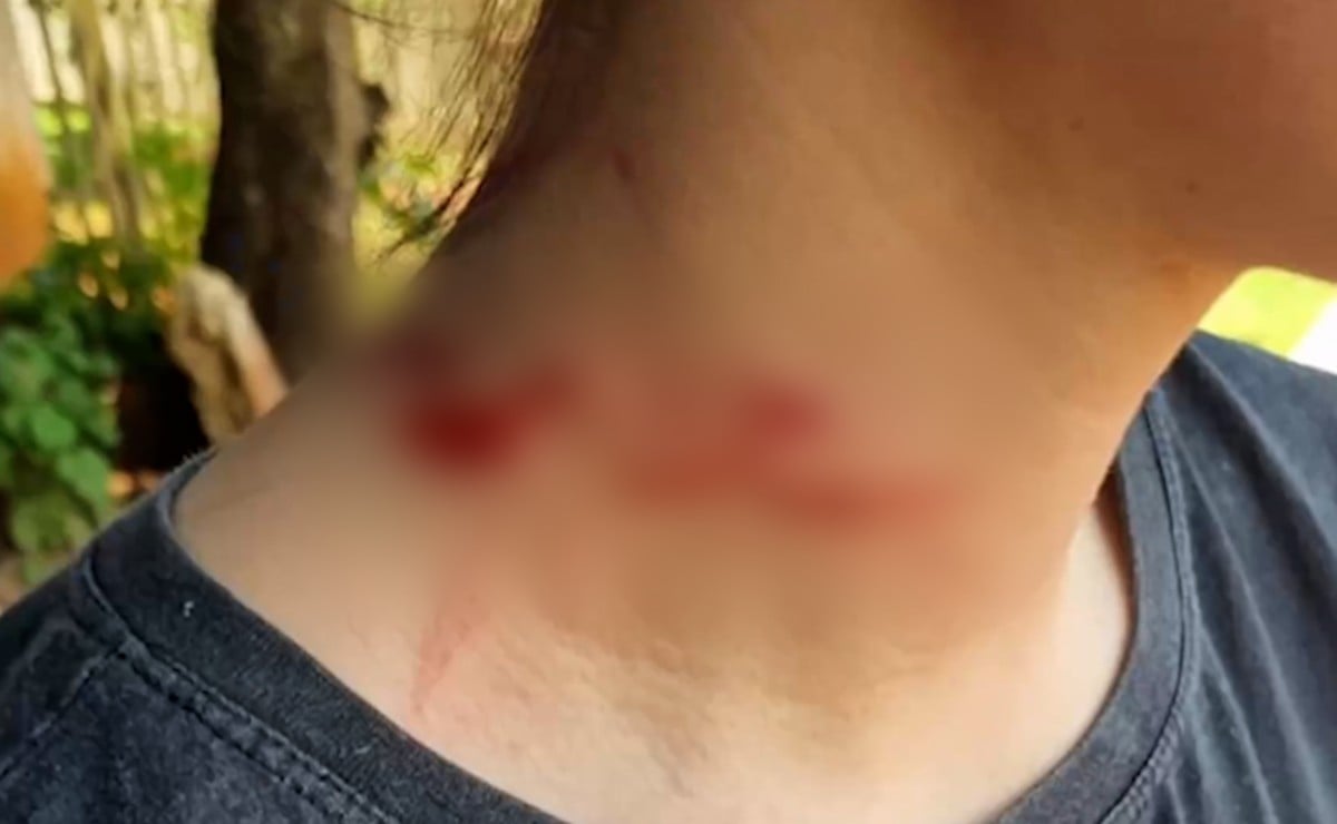 O pitbull herói salvou a garota atacada pelo irmão com uma faca no PR. - Foto: CGN