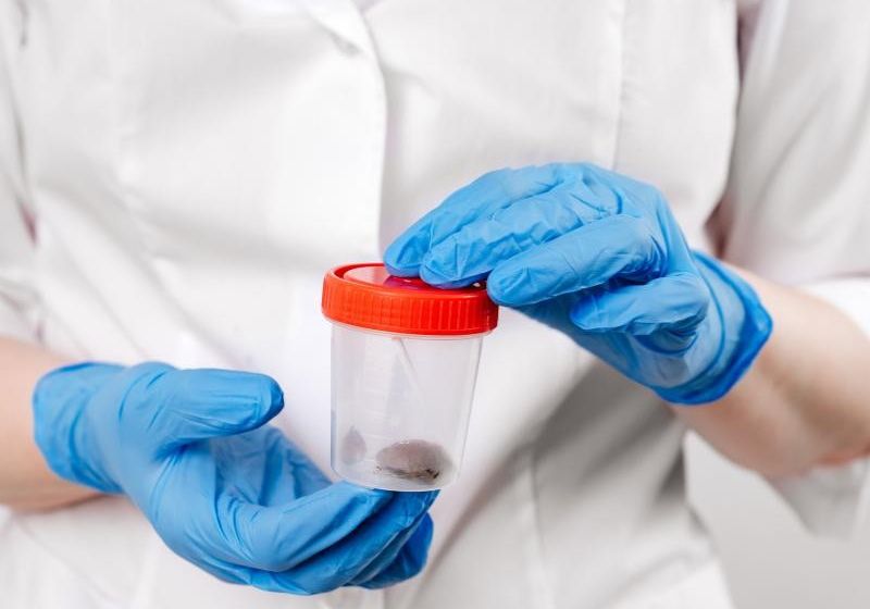 O novo teste de cocô criado na Suíca para detectar câncer de cólon se mostrou indolor, barato e eficaz no diagnóstico. - Foto: Instamed