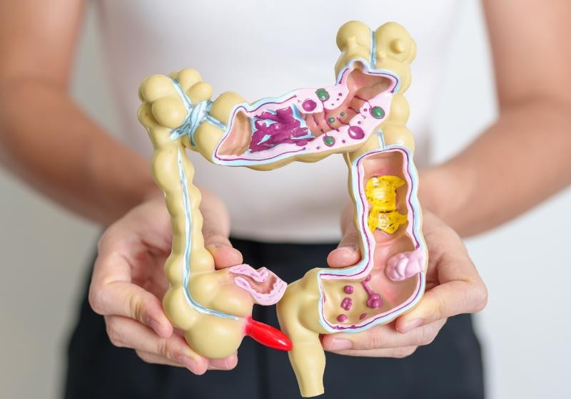 O novo teste para câncer de cólon utiliza fezes para identificar a doença e se mostrou eficaz nos diagnósticos - Foto: Canva