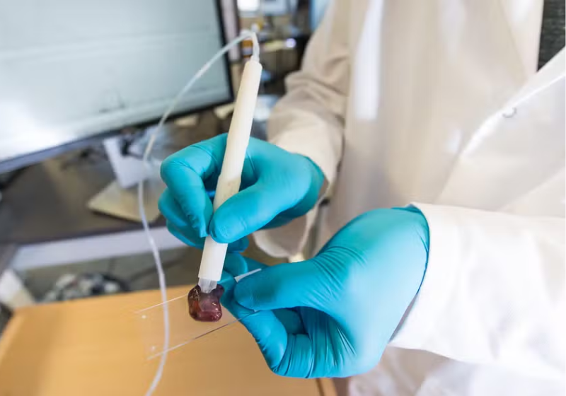 A caneta que ajuda a detectar câncer, através de um teste rápido, foi criada pela química brasileira Lívia Schiavinato Eberlin. - Foto: Vivian Abagiu/Universidade do Texas