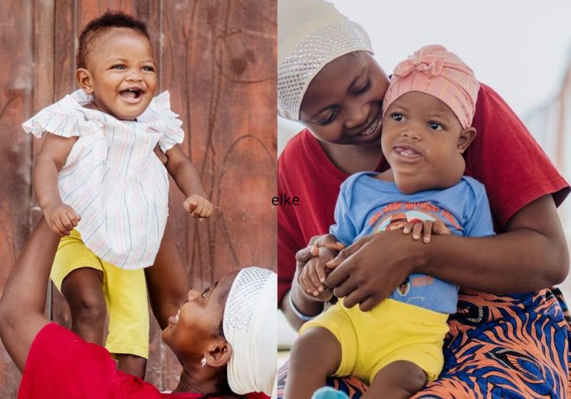 O cirurgião retirou de graça o tumor gigante da criança de 10 meses, que ia do pescoço até o rosto dela. A cirurgia foi no hospital a bordo do Global Mercy, atracado em Serra Leoa. - Fotos: SWNS / Mercy Ships