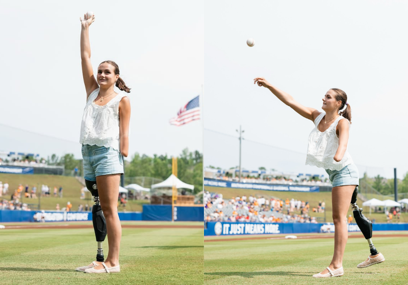 A adolescente Lulu Gribbin sofreu um ataque de tubarão em 2024 e hoje se prepara para disputar as paralimpíadas - Foto: Instagram