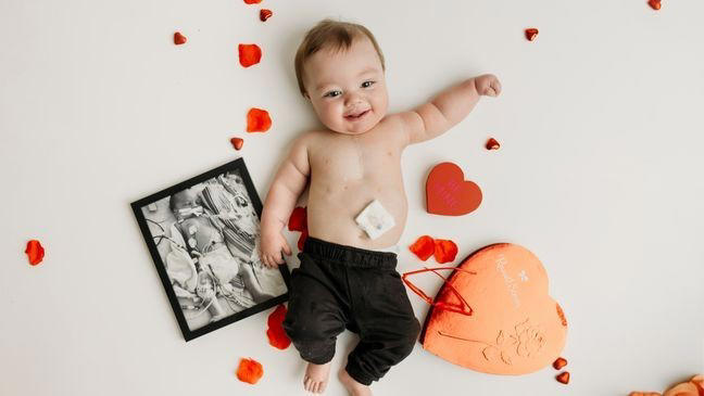 Xaiden nasceu com uma doença rara e não tem muito tempo de vida - Foto: arquivo pessoal