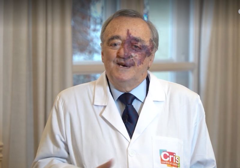 O cientista espanhol Mariano Barbacid conseguiu eliminar o câncer de pâncreas em ratos com a combinação de 3 medicamentos já conhecidos. - Foto: eleconomista.es