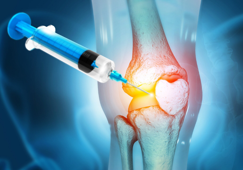 Uma nova injeção antienvelhecimento conseguiu melhorar as articulações do joelho. Agora pode ser usada em outros tratamentos - Foto: Pixbay