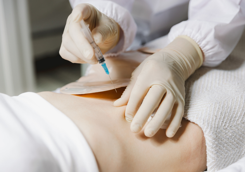 A nova injeção promete reorganizar as cêlulas do câncer e combater a doença sem intervenção cirúrgica - Foto: Canva