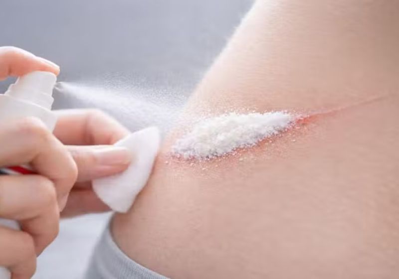 Cientistas da Coreia do Sul criaram o pó em spray que estanca hemorragia e sangramentos em 1 segundo e pode ser usado em pessoas baleadas. - Foto: reprodução