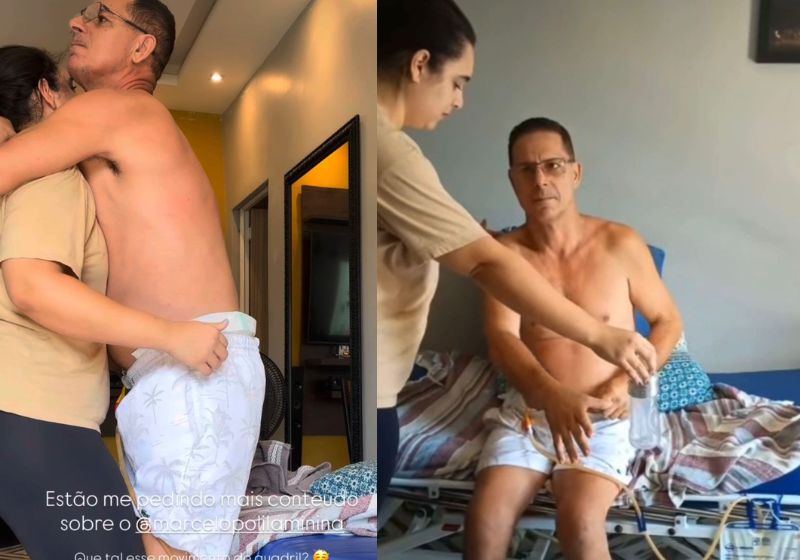 Marcelo, que ficou paraplégico após acidente no Rio, conseguiu ficar de pé, pela primeira vez, 1 mês após receber a injeção da polilaminina - Fotos: reprodução/Instagram
