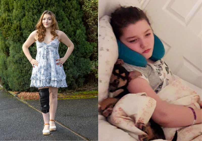 A jovem foi diagnosticada com uma síndrome rara postural, supera expectativas médicas e agora participa de um concurso de beleza - Foto: SWNS