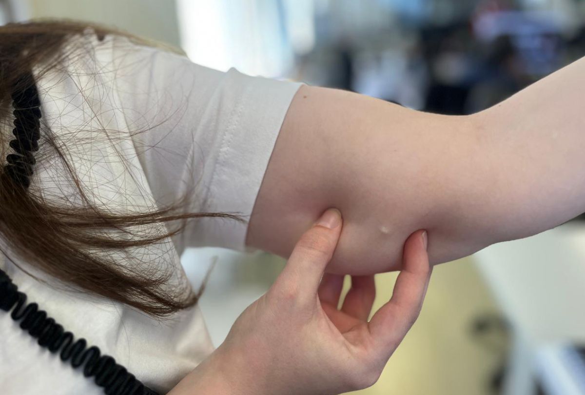 O implanon é considerado um dos métodos contraceptivos mais poderosos do mundo - Foto: Gov.br