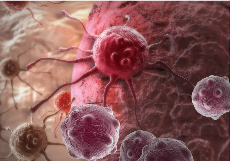 Uma bactéria que "come" o tumor de dentro para fora é a nova aposta de cientistas contra o câncer - Foto: Deposithphotos