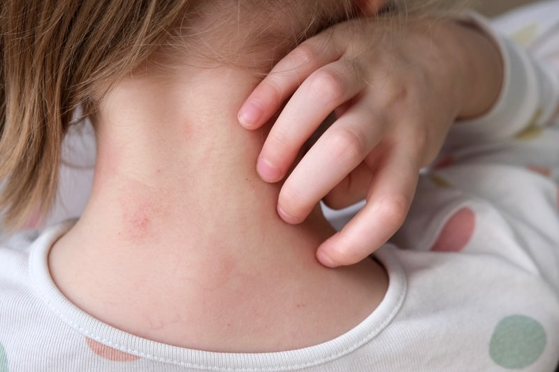 Os pesquisadores identificaram um padrão específico no cérebro, que pode facilitar o diagnóstico - Foto: Pixabay