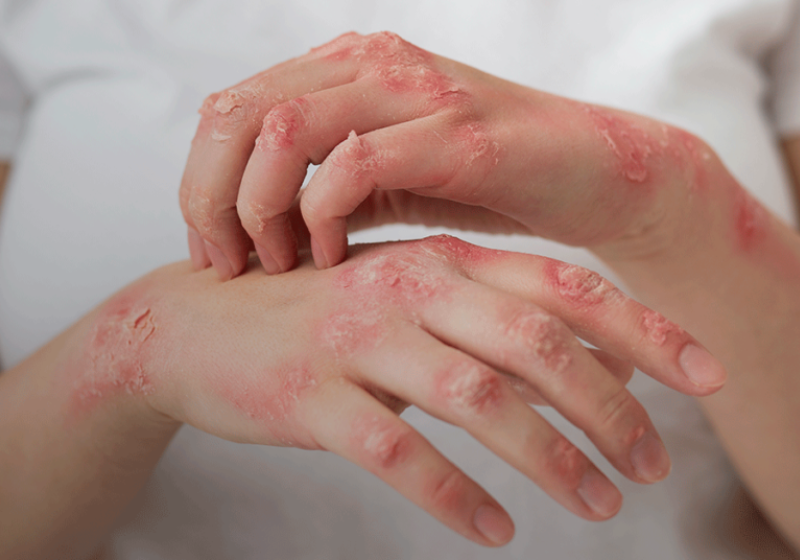 Com a nova pesquisa, o diagnóstico acontece muito mais rápido e a precisão pode chegar a 70%% - Foto: Pixabay