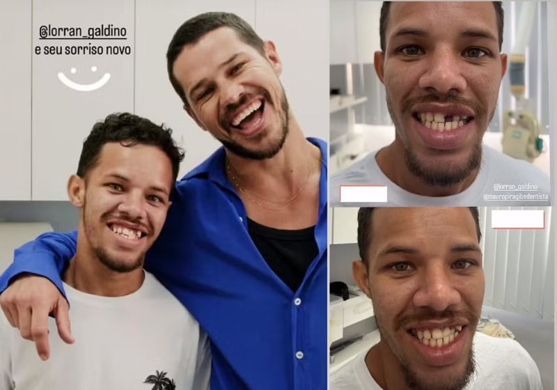 Lorran, o sósia de José Loreto, foi levado ao dentista pelo ator e já saiu de lá com um sorrisão feliz, após receber dente provisório. - Fotos: reprodução/ Instagram/ @lorran_galdino