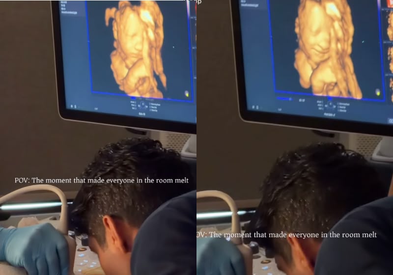 A bebê sorri no ultrassom 3D ao ouvir a voz do pai e o vídeo alcança 42 milhões de visualizações. Lia e Andrew são do Canadá. -Foto: Reprodução/ Instagram/ @liaolive_