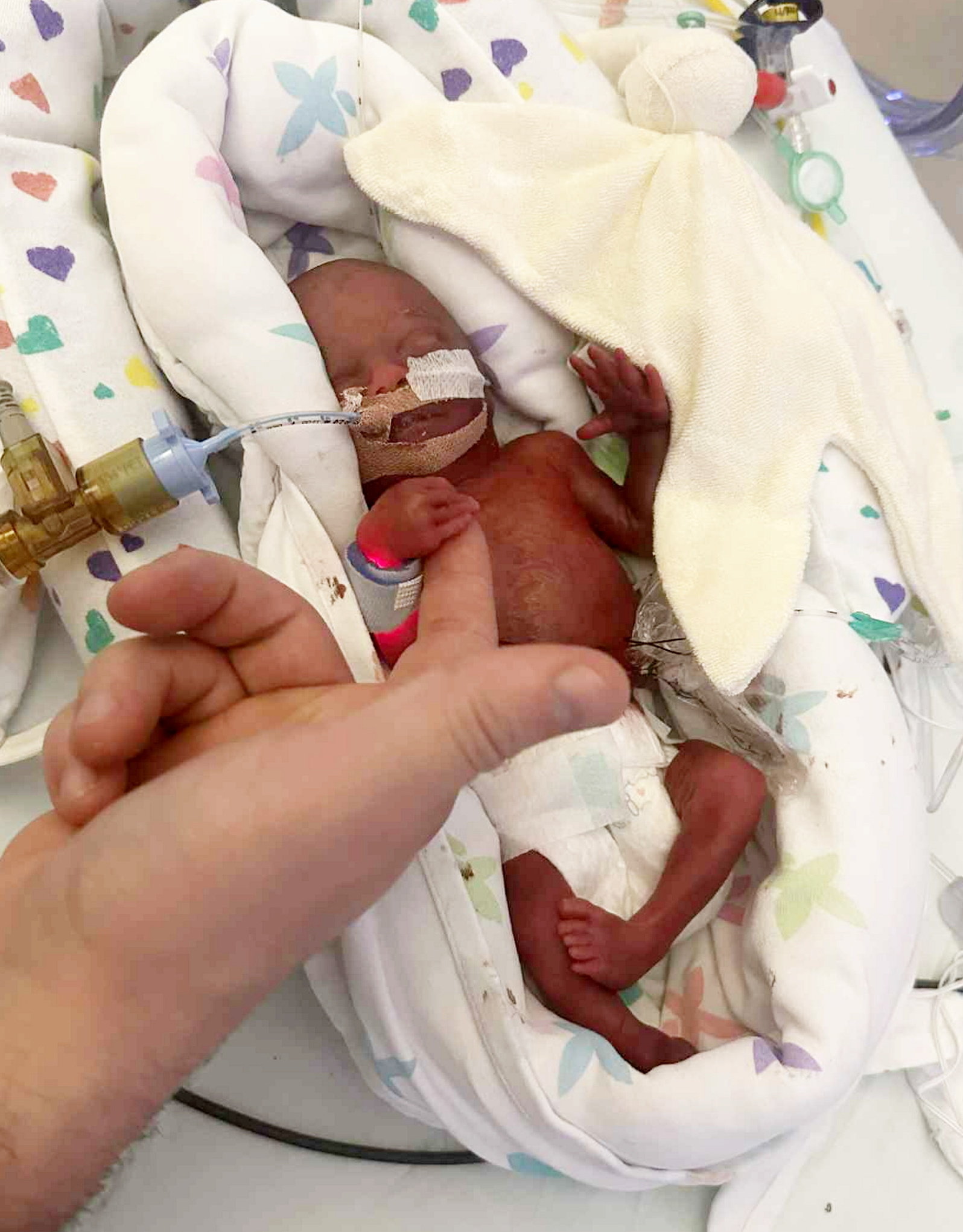 Olha o tamanho que a Hope nasceu. - Foto: NHS Fife / SWNS