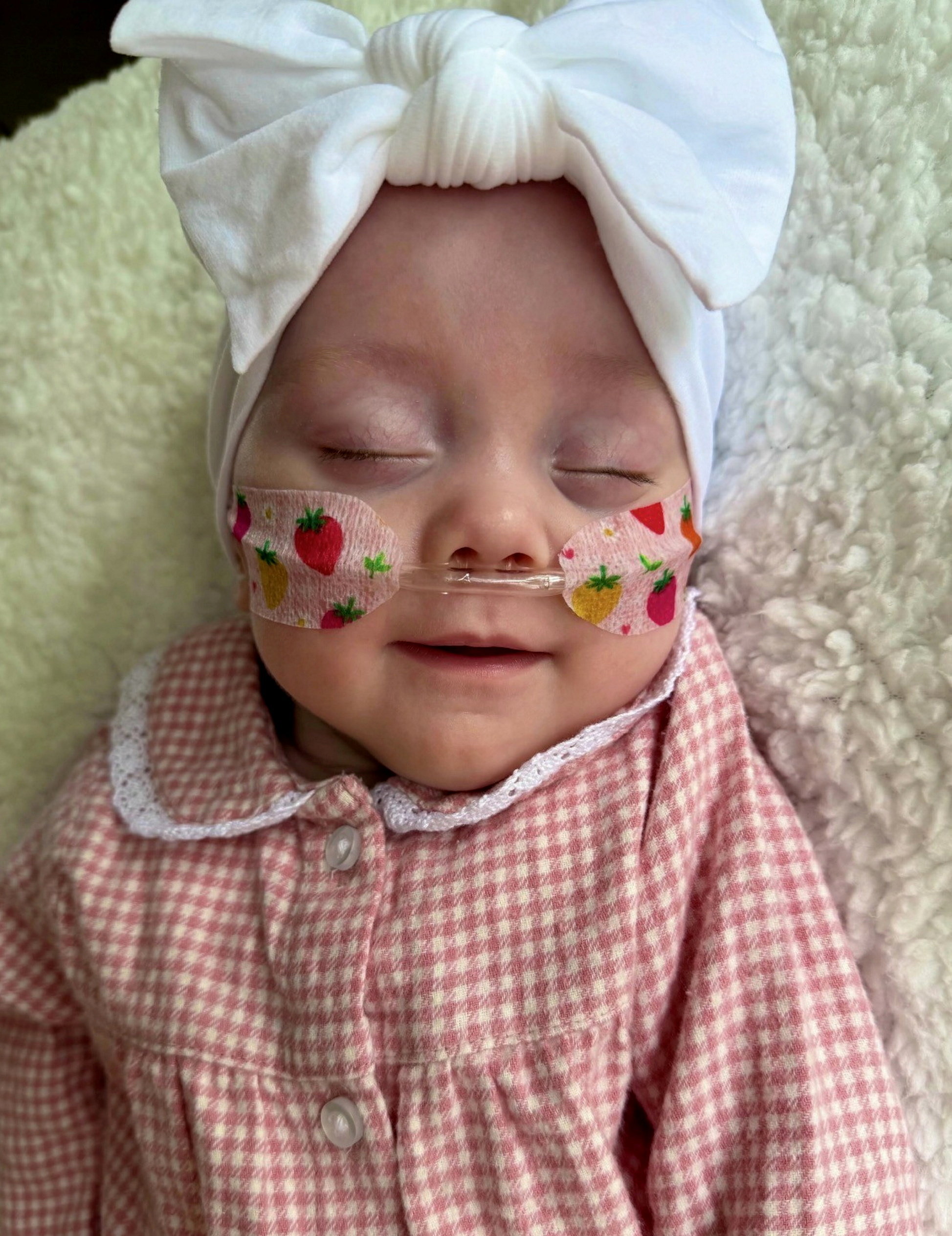 A pequena Hope dormindo, antes de ter alta do hospital. Foto: NHS Fife / SWNS