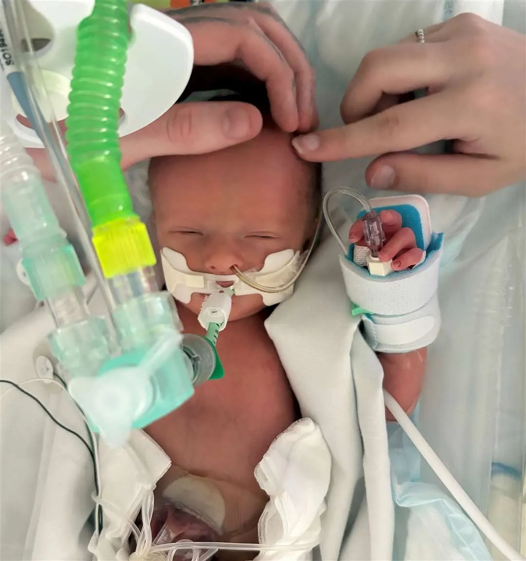 O bebê luca, que estava sem batimento cardíaco na barriga da mãe se recupera no hospital - Foto: Cover Images