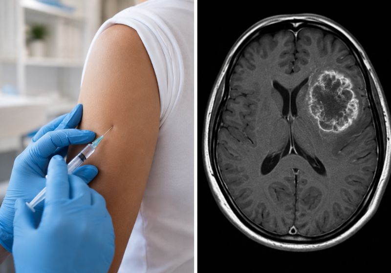 A vacina experimental contra tumor cerebral que impede a volta do câncer em 42% dos pacientes em estudo alemão saiu na revista Nature. - Foto: reprodução/ DKFZ