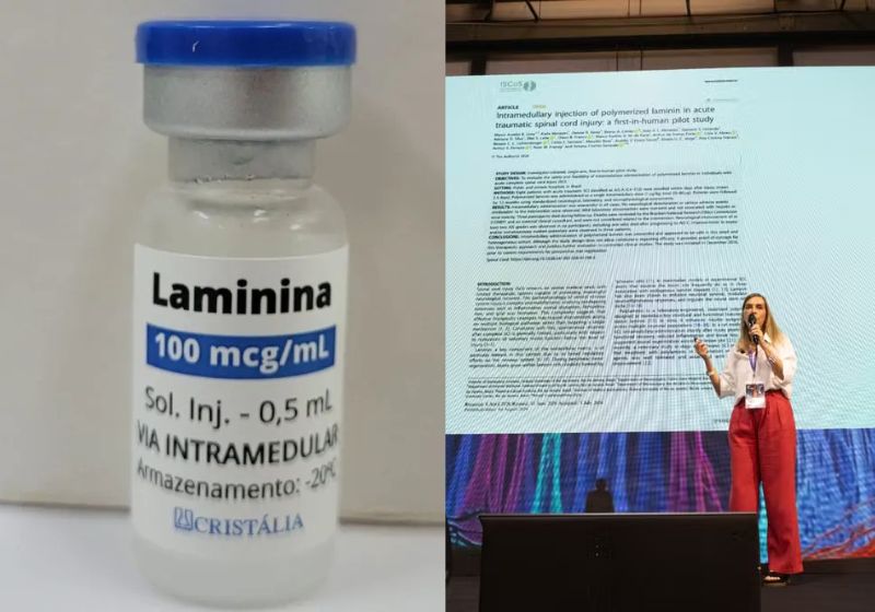 O estudo da polilaminina da Dra. Tatiana Sampaio foi publicado pela Spinal Cord e saiu na revista Nature: 75% dos pacientes apresentaram melhora neurológica. - Fotos: divulgação