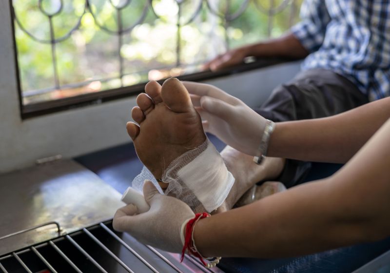 Nanopartícula para feridas crônicas criada na USP de Ribeirão Preto praticamente fechou uma lesão simulada em 72 horas. - Foto: Shutterstock