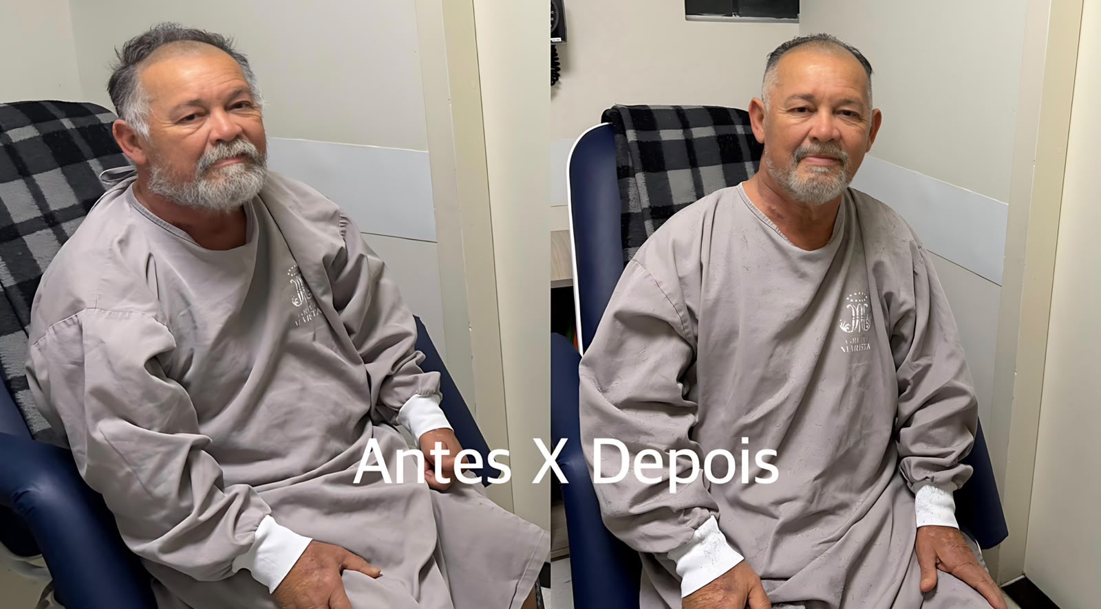 O antes e depois do seu Hélio, paciente com infarto que teve o cabelo cortado pelo enfermeiro no hospital de Curitiba. - Foto: Divulgação/Hospital Universitário Cajuru