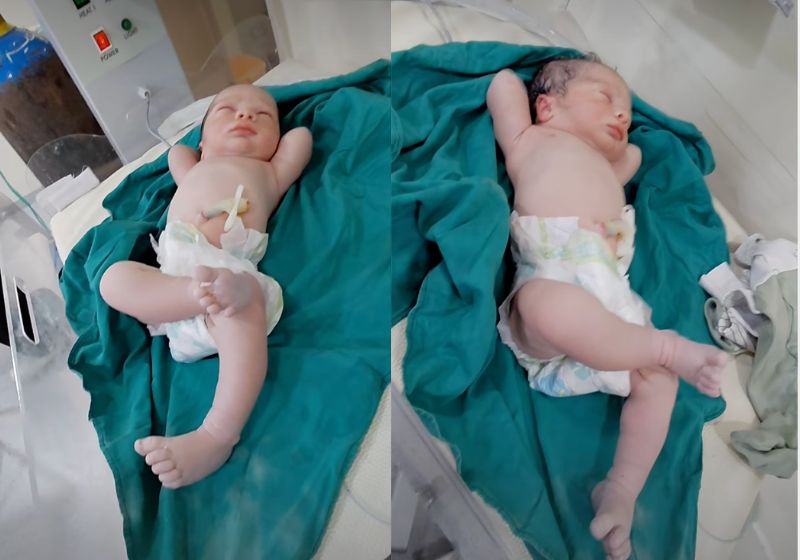 O bebê recém-nascido fez pose de milionário: apareceu com os braços atrás da cabeça e uma perna cruzada logo após o parto. Cena foi publicada por médico no Egito. - Foto: reprodução/ Instagram/ @drmohamed_ali_atia