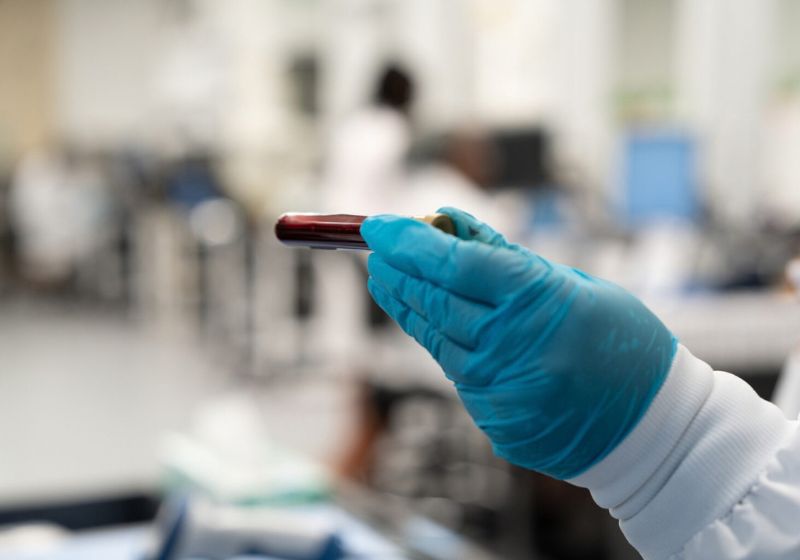 O novo exame de sangue, chamado Teste Galleri, procura sinais de 50 tipos de câncer e acertou 93% dos sinais, informou a revista científica Nature. Falta a FDA aprovar. - Foto: reprodução/ Grail