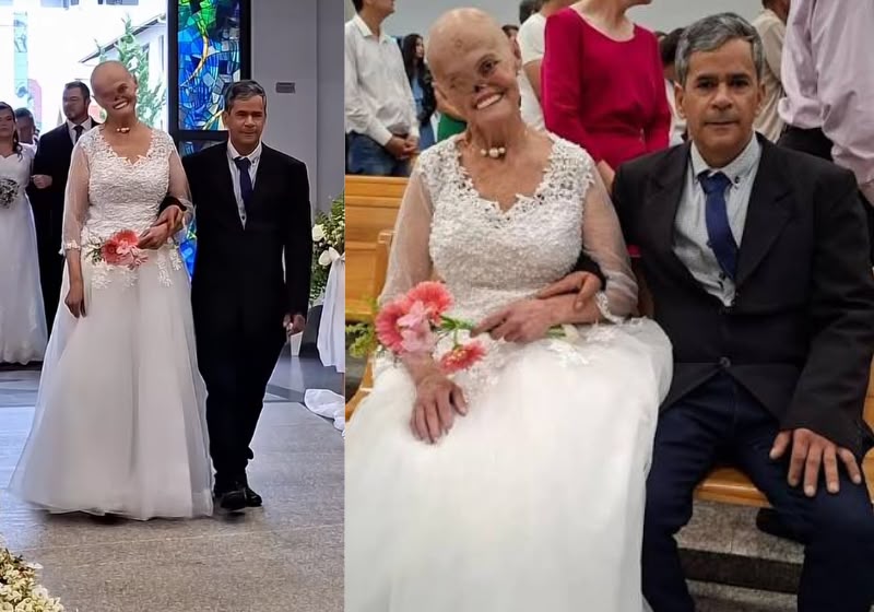 Hilária Mireski e Adão Pereira se conheceram durante o tratamento dela em um hospital de Curitiba e agora se casaram, sete anos depois. - Foto: Reprodução/ Instagram / @hilariamireski