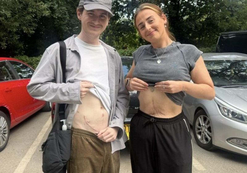 A jovem Rachel Ware, de 24 anos, doa um rim ao irmão Harry, de 22, após ele ser diagnosticado com síndrome de Alport. - Foto: Manchester University NHS/SWNS