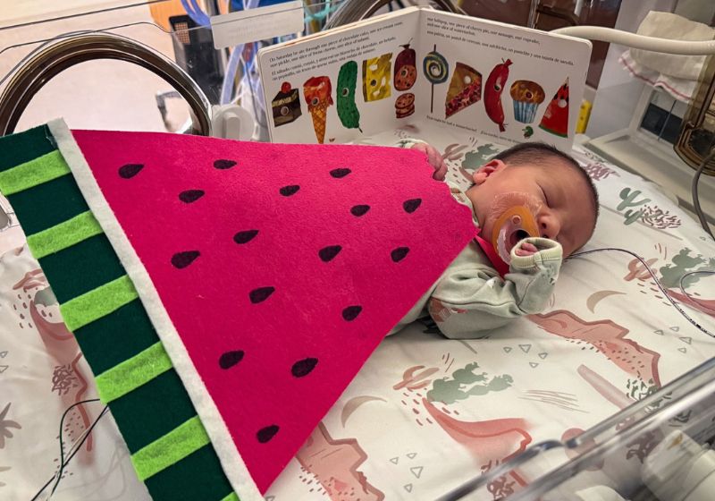 Neste Halloween, enfermeiras fantasiam bebês internados na UTI neonatal de hospital nos Estados Unidos, como o Lucca, vertido de melancia. - Foto: reprodução/ Riley Childrens Hospital