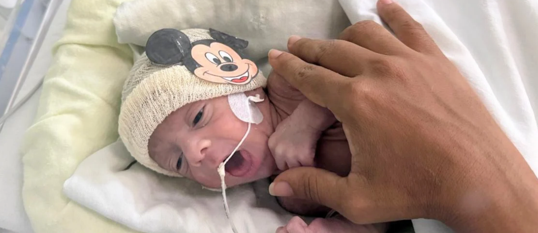Bebê internado no HUC, em Fortaleza, ganhou uma touquinha personalizada com o personagem Mickey durante ação especial do Mês das Crianças. Foto: Gabriela Moraes/Comunicação Sesa